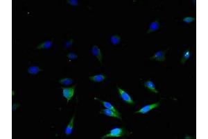 Immunofluorescent analysis of U251 cells using ABIN7159955 at dilution of 1:100 and Alexa Fluor 488-congugated AffiniPure Goat Anti-Rabbit IgG(H+L) (UCP3 antibody  (AA 33-76))