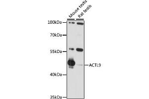 Western blot analysis of extracts of various cell lines, using  antibody (ABIN7265389) at 1:1000 dilution. (ACTL9 antibody  (AA 1-416))