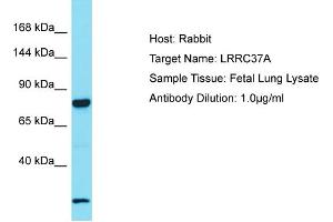 Host: Rabbit Target Name: LRRC37A2 Sample Tissue: Human Fetal Lung Antibody Dilution: 1ug/ml (LRRC37A antibody  (C-Term))