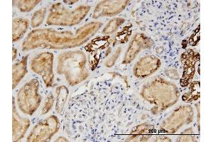 Immunoperoxidase of monoclonal antibody to AGT on formalin-fixed paraffin-embedded human kidney. (AGT antibody  (AA 1-485))