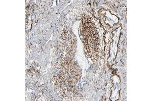 Immunohistochemical staining of human smooth muscle with FBLN5 polyclonal antibody  shows cytoplasmic positivity in smooth muscle cells at 1:50-1:200 dilution. (Fibulin 5 antibody)