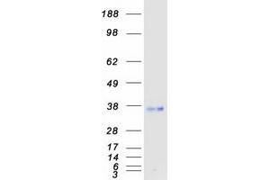 Validation with Western Blot