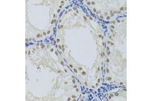 Immunohistochemistry of paraffin-embedded rat testis using DDB1 Antibody. (DDB1 antibody)