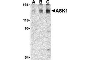 Western Blotting (WB) image for anti-Mitogen-Activated Protein Kinase Kinase Kinase 5 (MAP3K5) antibody (ABIN1030199) (ASK1 antibody)