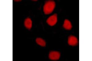 ABIN6269102 staining MCF-7 cells by ICC/IF. (Progesterone Receptor antibody)