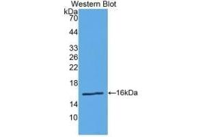 Detection of Recombinant Renin, Human using Polyclonal Antibody to Renin (REN) (Renin antibody  (AA 67-153))