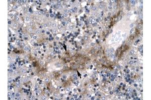 ZNF365 antibody was used for immunohistochemistry at a concentration of 4-8 ug/ml to stain Hepatocyte (arrows) in Human Liver. (ZNF365 antibody  (N-Term))
