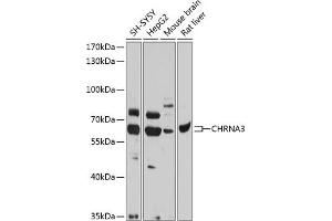 Western blot analysis of extracts of various cell lines, using CHRN antibody (ABIN6133178, ABIN6138575, ABIN6138576 and ABIN6218768) at 1:1000 dilution. (CHRNA3 antibody  (AA 32-240))