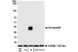 Western Blotting (WB) image for anti-Granzyme B (GZMB) (AA 19-247) antibody (ABIN7449554)