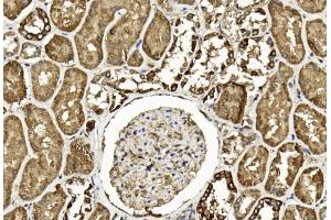 Immunohistochemical analysis of paraffin-embedded Human kidney section using Pink1 am1893b. (TGFB2 antibody)