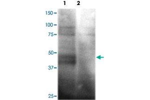 Western blot analysis of HEK293 cells over-expressing SLC2A1 (Lane 1) or a nono-specific control receptor (Lane 2) using SLC2A1 polyclonal antibody  at 1:200 dilution. (GLUT1 antibody)