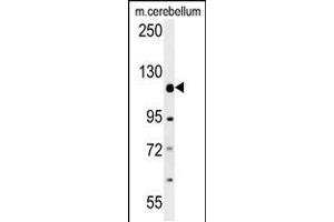 Western blot analysis in mouse cerebellum tissue lysates (15ug/lane). (Radil antibody  (C-Term))