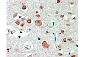 Immunohistochemistry (IHC) image for anti-gamma-aminobutyric Acid (GABA) A Receptor, alpha 4 (GABRA4) (Internal Region) antibody (ABIN335137)