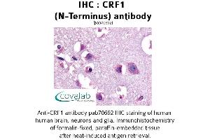 Image no. 1 for anti-Corticotropin Releasing Hormone Receptor 1 (CRHR1) (Extracellular Domain), (N-Term) antibody (ABIN1733304) (CRHR1 antibody  (Extracellular Domain, N-Term))