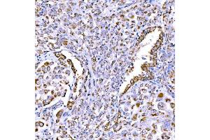IHC analysis of SUCLG1 using anti-SUCLG1 antibody (ABIN7600906).