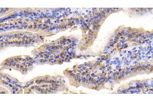 Detection of FABP2 in Bovine Small intestine Tissue using Polyclonal Antibody to Fatty Acid Binding Protein 2, Intestinal (FABP2) (FABP2 antibody  (AA 2-128))