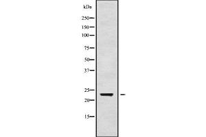 Western blot analysis of RAB24 using Jurkat whole cell lysates (RAB24 antibody  (Internal Region))