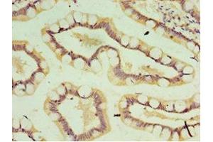 Immunohistochemistry of paraffin-embedded human small intestine tissue using ABIN7156912 at dilution of 1:100 (IL-37 antibody  (AA 1-218))