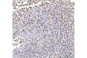 IHC analysis of IL22 using anti-IL22 antibody (ABIN5518929).