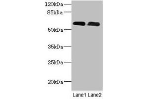 Western Blot All lanes: PNPLA1 antibody at 12 μg/mL Lane 1: Mouse spleen tissue Lane 2: Mouse skeletal muscle tissue Secondary Goat polyclonal to rabbit IgG at 1/10000 dilution Predicted band size: 58, 48, 49 kDa Observed band size: 58 kDa (PNPLA1 antibody  (AA 101-300))