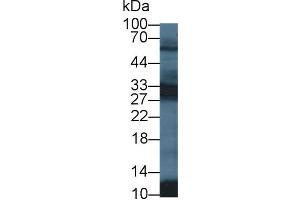 Western Blot; Sample: Mouse Testis lysate; Primary Ab: 1µg/ml Rabbit Anti-Human PGAM2 Antibody Second Ab: 0. (PGAM2 antibody  (AA 1-236))