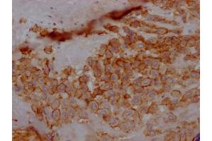 IHC image of ABIN7127316 diluted at 1:100 and staining in paraffin-embedded human placenta tissue performed on a Leica BondTM system. (Recombinant TPBG antibody)