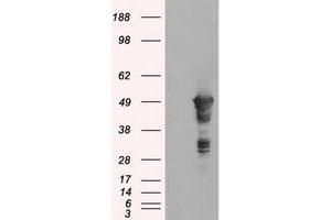 Image no. 1 for anti-Glial Fibrillary Acidic Protein (GFAP) antibody (ABIN1498442) (GFAP antibody)