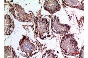 Immunohistochemistry (IHC) image for anti-Patatin-Like phospholipase Domain Containing 6 (PNPLA6) (Internal Region) antibody (ABIN3187873)
