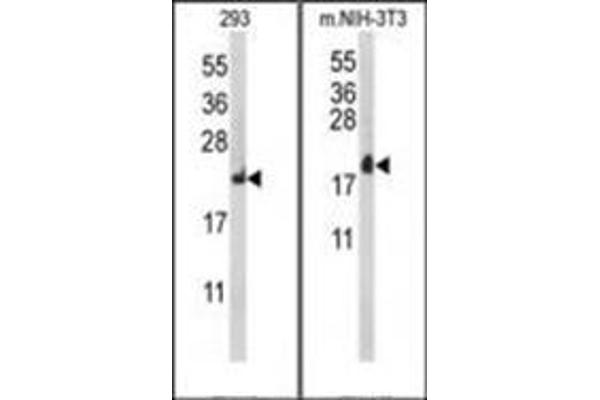 RPL18A antibody  (C-Term)