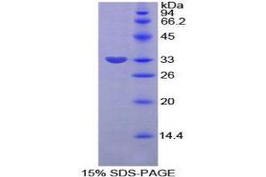 SDS-PAGE (SDS) image for Plasminogen Activator Inhibitor 2 (SERPINB2) (AA 154-408) protein (His tag) (ABIN2126325)