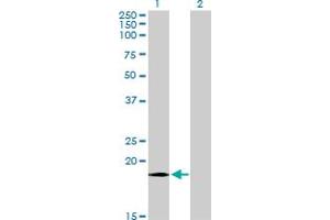 Western Blot analysis of COX4I1 expression in transfected 293T cell line by COX4I1 monoclonal antibody (M08), clone 4A10. (COX IV antibody  (AA 1-169))