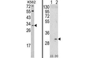 (LEFT) Western blot analysis of ITM2A Antibody (N-term) in K562 cell line lysates (35ug/lane). (ITM2A antibody  (N-Term))