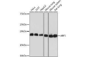Western blot analysis of extracts of various cell lines, using  Rabbit mAb (ABIN7265479) at 1:1000 dilution.