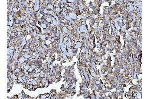 IHC analysis of CD147/Emmprin using anti-CD147/Emmprin antibody (ABIN7599999). (CD147 antibody  (AA 138-323))