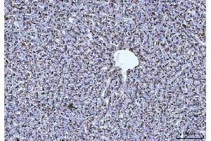 IHC analysis of Cathepsin B/CTSB using anti-Cathepsin B/CTSB antibody (ABIN7601692). (Cathepsin B antibody  (AA 42-339))