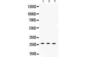 Western blot analysis of DDAH2 expression in rat lung extract ( Lane 1), mouse lung extract ( Lane 2) and human placenta extract ( Lane 3).
