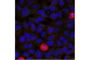 Image no. 1 for anti-Eukaryotic Translation Initiation Factor 4 Gamma, 1 (EIF4G1) (Ser1232) antibody (ABIN319387) (EIF4G1 antibody  (Ser1232))