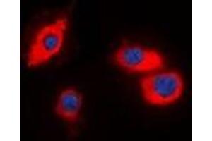 Immunofluorescent analysis of CIDEB staining in HT29 cells. (CIDEB antibody)