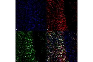 Immunocytochemistry/Immunofluorescence analysis using Rabbit Anti-Alpha Synuclein pSer129 Polyclonal Antibody (ABIN5650941). (SNCA antibody  (pSer129) (Atto 594))