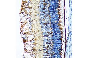 Immunohistochemistry of paraffin-embedded mouse retina using CRALBP Rabbit mAb (ABIN7269934) at dilution of 1:100 (40x lens). (RLBP1 antibody)