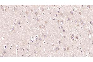 Detection of MOG in Human Cerebrum Tissue using Monoclonal Antibody to Myelin Oligodendrocyte Glycoprotein (MOG) (MOG antibody  (AA 30-149))