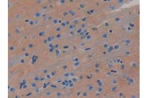 #VALUE! (LRIG3 antibody  (AA 866-1110))