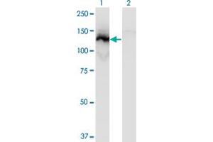 Western Blot analysis of SSH1 expression in transfected 293T cell line by SSH1 monoclonal antibody (M12), clone 2F9. (SSH1 antibody  (AA 752-849))
