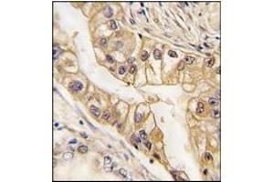 Immunohistochemistry (IHC) image for anti-EPH Receptor B2 (EPHB2) antibody (ABIN356401) (EPH Receptor B2 antibody)