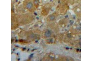 Used in DAB staining on fromalin fixed paraffin-embedded Liver tissue (Zinc Finger Protein CONSTANS-LIKE 9-Like (COL9) (AA 1572-1754) antibody)
