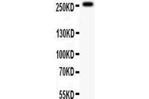 Anti-ABCA4 antibody, Western blotting All lanes: Anti ABCA4  at 0. (ABCA4 antibody  (C-Term))