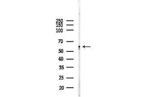Western blot analysis of lysates from Mouse testis, using ATP5 Antibody at 1/1000 dilution.