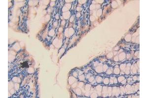 Used in DAB staining on fromalin fixed paraffin- embedded kidney tissue (ATP1B1 antibody  (AA 53-304))