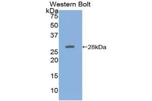 Western blot analysis of the recombinant protein. (ADCY5 antibody  (AA 167-385))