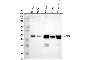 Western blot analysis of PADH4 using anti-ADH4 antibody (ABIN4886428).